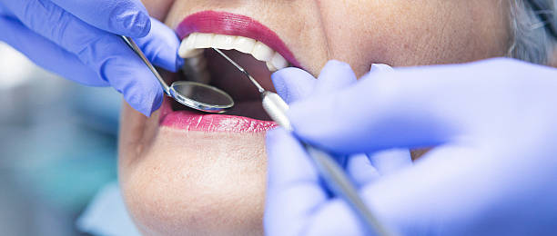 Best Urgent Care for Lost Fillings or Crowns in Bloomington, CA